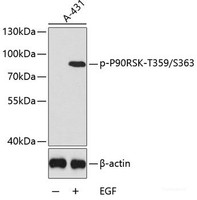 Western blot analysis of extracts of A431 cells using Phospho-P90RSK (T359/S363) Polyclonal Antibody.