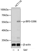 Western blot analysis of extracts of HCT116 cells using Phospho-IRF3 (S396) Polyclonal Antibody at dilution of 1:1000.