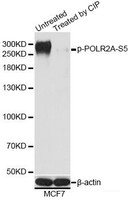 Western blot analysis of extracts of MCF7 cells using Phospho-POLR2A (S5) Polyclonal Antibody at dilution of 1:1000. MCF7 cell lysate were treated by CIP (20ul CIP for each 400ul cell lysate) at 37°C for 1 hour.