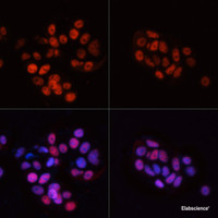 Immunofluorescence analysis of MCF7 cells using Phospho-POLR2A (S5) Polyclonal Antibody at dilution of 1:100. MCF7 cells were treated by nocodazole (50 ng/ml) at 37℃ for 20 hours (left) . Blue: DAPI for nuclear staining.