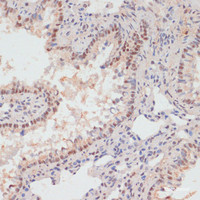 Immunohistochemistry of paraffin-embedded Rat lung using Phospho-PEA15 (S104) Polyclonal Antibody at dilution of 1:100 (40x lens) .