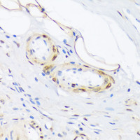 Immunohistochemistry of paraffin-embedded Human appendix using Phospho-PLN (T17) Polyclonal Antibody at dilution of 1:100 (40x lens) .