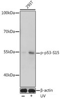 Western blot analysis of extracts of 293T cells using Phospho-p53 (S15) Polyclonal Antibody at dilution of 1:1000. 293T cells were treated by UV at room tempeRature for 15-30 minutes.