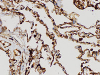 Immunohistochemistry of paraffin-embedded Human lung using S100A4 Polycloanl Antibody at dilution of 1:200