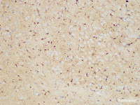 Immunohistochemistry of paraffin-embedded Mouse brain using S100B Polycloanl Antibody at dilution of 1:50