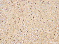 Immunohistochemistry of paraffin-embedded Rat brain using S100B Polycloanl Antibody at dilution of 1:50