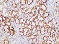 Immunohistochemistry of paraffin-embedded Human kidney using IL2 Polycloanl Antibody at dilution of 1:300