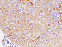 Immunohistochemistry of paraffin-embedded Mouse kidney using L1CAM Polycloanl Antibody at dilution of 1:300