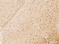 Immunohistochemistry of paraffin-embedded Mouse brain using FLT3 Polycloanl Antibody at dilution of 1:200