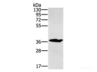 Western Blot analysis of Mouse liver tissue using NOV Polyclonal Antibody at dilution of 1:300
