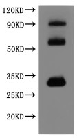 Recombinant Human Claudin-18.2(CLDN18.2)-VLPs (Active) detected by Mouse anti-6*His monoclonal antibody. The three bands respectively correspond to monomer, Homodimer, Homotrimer