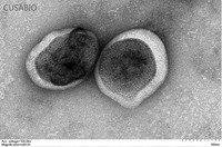 The presence of VLP-like structures was confirmed by TEM