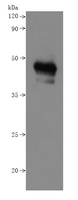 Recombinant Human B-lymphocyte antigen CD20 (MS4A1) - VLPs (Active) is detected by Mouse anti-6*His monoclonal antibody.