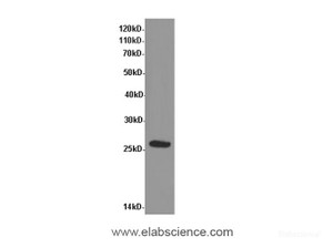 Western Blot analysis of Rat heart tissue using ADIPOQ Polyclonal Antibody at dilution of 1:600