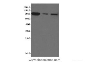 Western Blot analysis of Hela, A549 cells and Rat liver tissue using HSP70 Polyclonal Antibody at dilution of 1:600