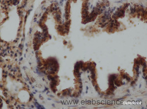 Immunohistochemistry of paraffin-embedded Rat lung using EPO Polyclonal Antibody at dilution of 1:50