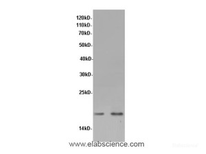 Western Blot analysis of Rat lung and Mouse lung tissue using TSHB Polyclonal Antibody at dilution of 1:600