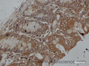 Immunohistochemistry of paraffin-embedded Rat colon using IFNB1 Polyclonal Antibody at dilution of 1:50