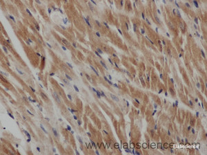 Immunohistochemistry of paraffin-embedded Rat heart using IL2 Polyclonal Antibody at dilution of 1:50