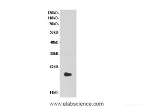 Western Blot analysis of Mouse liver tissue using ARF6 Polyclonal Antibody at dilution of 1:600