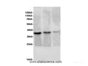 Western Blot analysis of Rat liver, Rat lung tissue and Jurkat cells using AIMP2 Polyclonal Antibody at dilution of 1:600