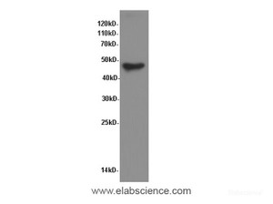 Western Blot analysis of A549 cells using Smad3 Polyclonal Antibody at dilution of 1:600