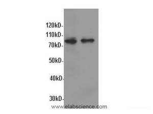 Western Blot analysis of Hela and A549 cells using STAT1 Polyclonal Antibody at dilution of 1:600