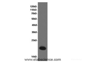 Western Blot analysis of Hela cells using CAMP Polyclonal Antibody at dilution of 1:600
