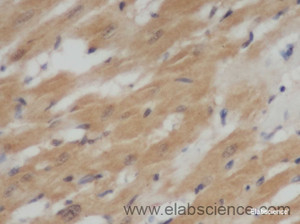 Immunohistochemistry of paraffin-embedded Rat heart using IL6 Polyclonal Antibody at dilution of 1:50