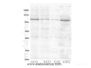 Western Blot analysis of 293T, A431, A549 and K562 cells using PARP3 Polyclonal Antibody at dilution of 1:600