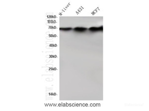 Western Blot analysis of Mouse liver, A431 and MCF7 cells using ALPL Polyclonal Antibody at dilution of 1:600