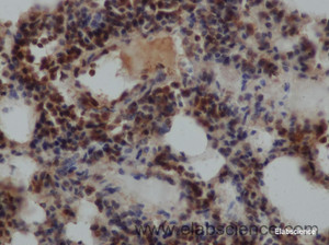 Immunohistochemistry of paraffin-embedded Rat lung using EDN1 Polyclonal Antibody at dilution of 1:50