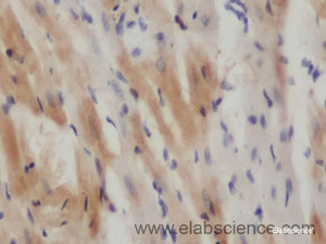 Immunohistochemistry of paraffin-embedded Rat heart using FABP3 Polyclonal Antibody at dilution of 1:50