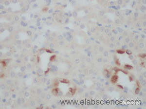 Immunohistochemistry of paraffin-embedded Rat kidney using TNFSF13B Polyclonal Antibody at dilution of 1:50