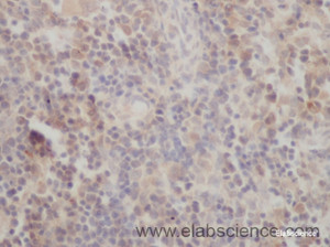 Immunohistochemistry of paraffin-embedded Mouse spleen using P73 Polyclonal Antibody at dilution of 1:50