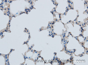 Immunohistochemistry of paraffin-embedded Mouse lung using MMP1 Polyclonal Antibody at dilution of 1:50
