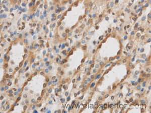 Immunohistochemistry of paraffin-embedded Rat kidney using IL10RB Polyclonal Antibody at dilution of 1:50