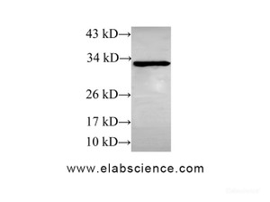 Western Blot analysis of Rat heart using STOM Polyclonal Antibody at dilution of 1:600