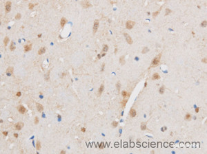 Immunohistochemistry of paraffin-embedded Mouse brain using THRAP3 Polyclonal Antibody at dilution of 1:50