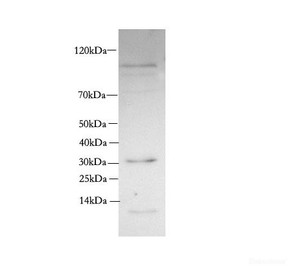 Western Blot analysis of Rat skeletal muscle using SIX2 Polyclonal Antibody at dilution of 1:600