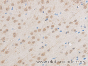 Immunohistochemistry of paraffin-embedded Mouse brain using EIF5A2 Polyclonal Antibody at dilution of 1:50