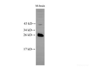 Western Blot analysis of Mouse brain tissue using RAB5B Polyclonal Antibody at dilution of 1:500