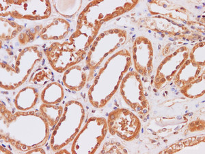 Immunohistochemistry of paraffin-embedded Human kidney using ITPKB Polyclonal Antibody at dilution of 1:200