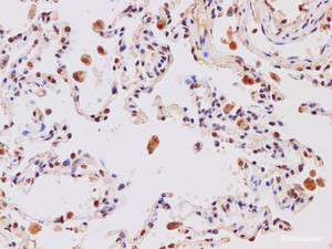 Immunohistochemistry of paraffin-embedded Human lung using IL27 Polyclonal Antibody at dilution of 1:200