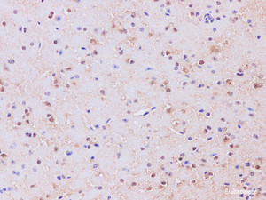 Immunohistochemistry of paraffin-embedded Mouse brain using GAD1 Polyclonal Antibody at dilution of 1:200