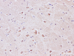 Immunohistochemistry of paraffin-embedded Rat brain using JNK1 Polyclonal Antibody at dilution of 1:200