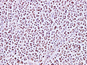 Immunohistochemistry of paraffin-embedded Human lymph node using MCM3 Polyclonal Antibody at dilution of 1:200