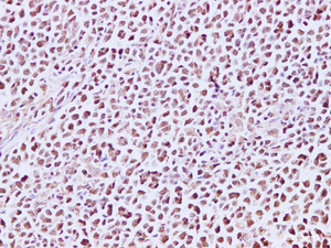 Immunohistochemistry of paraffin-embedded Human lymph node using MCM7 Polyclonal Antibody at dilution of 1:200