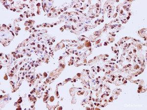 Immunohistochemistry of paraffin-embedded Human lung using CDC46 Polyclonal Antibody at dilution of 1:200