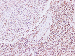 Immunohistochemistry of paraffin-embedded Human Tonsil tissue using RAC2 Polyclonal Antibody at dilution of 1:200